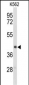 ENTPD2 Antibody (N-term)